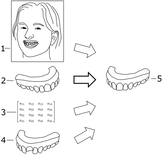 Dental design transfer
